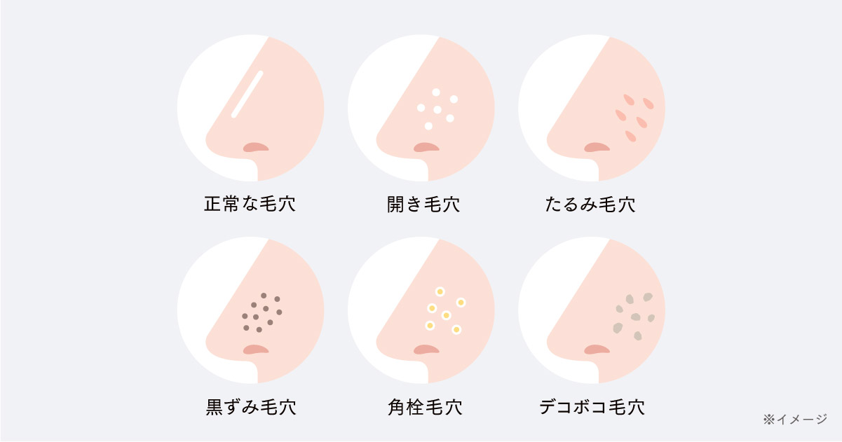 毛穴開き 完全ガイド｜今日からできる生活習慣・自宅ケア・美容アイテム活用術