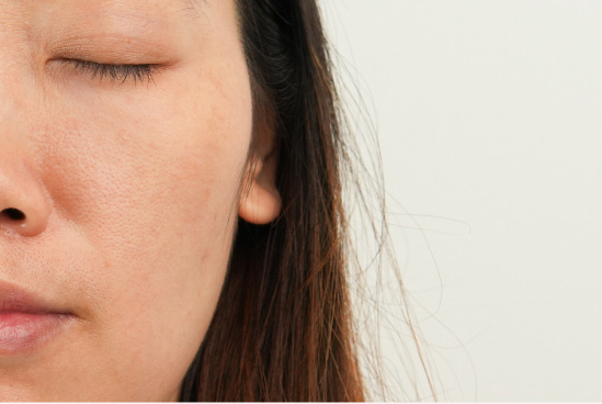 MiRAY AIRはブライトモードで肌のくすみやキメのケアが可能です