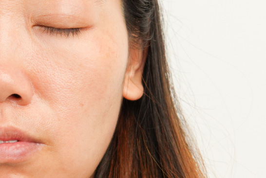 MiRAY AIRはブライトモードで肌のくすみやキメのケアが可能です