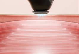 MYTREX マイトレックス 美顔器MiRAY ONE全ての肌悩みに応えるハイパワーな5つの機能