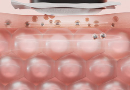 MYTREX マイトレックス 美顔器MiRAY ONE全ての肌悩みに応えるハイパワーな5つの機能