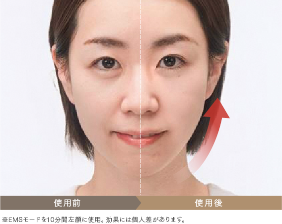 MYTREX マイトレックス 美顔器のEMS機能を使用した効果