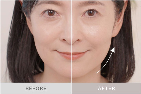 PROVE　CORE(ブラシ型アタッチメント使用による)印象の変化