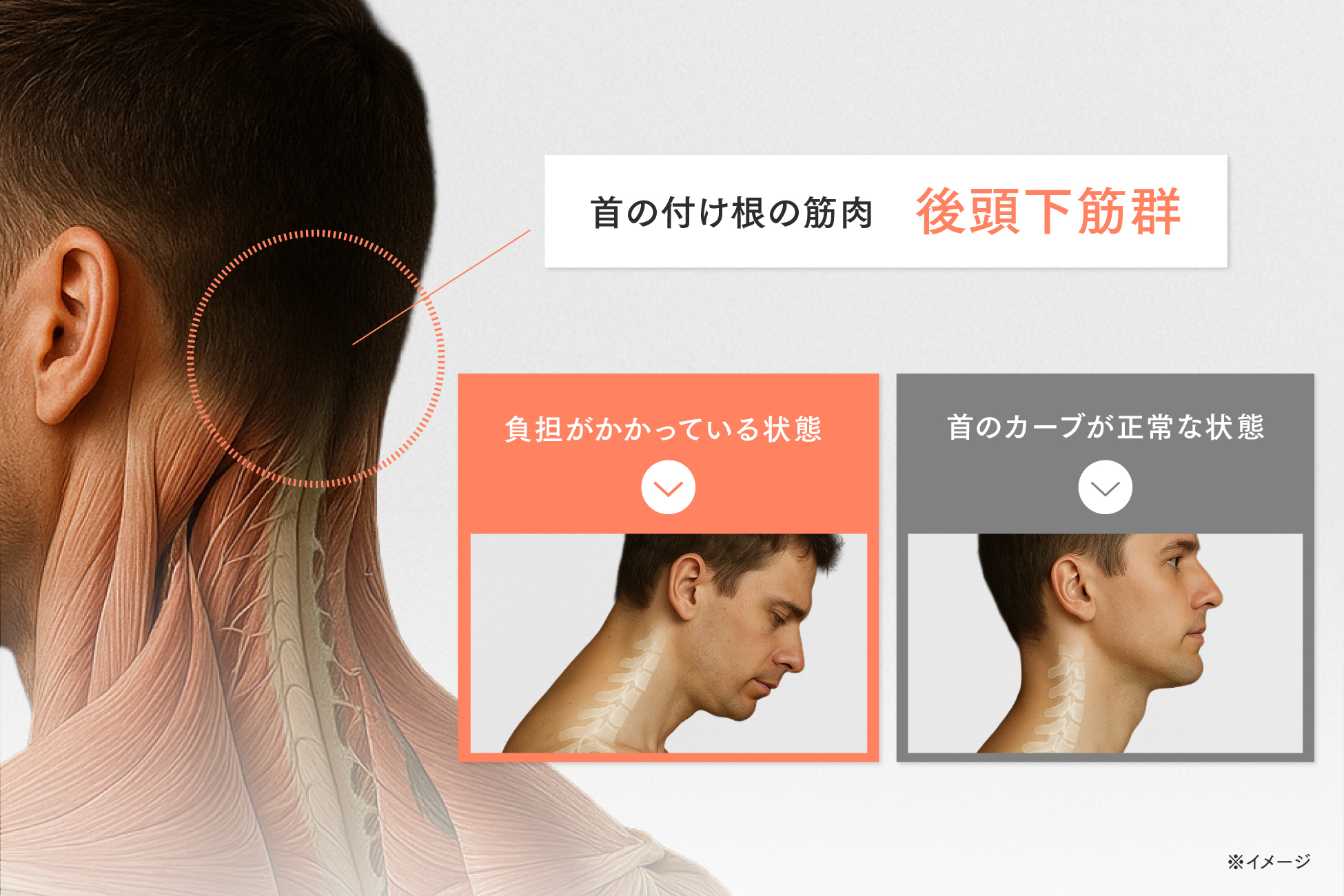 首ケアが第2世代へ。つらい目や首の悩みの根本に向き合って進化した「RESET NECK」誕生。