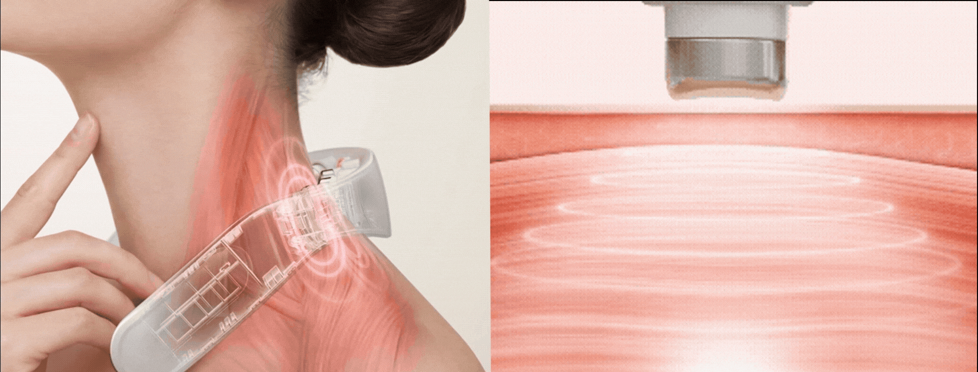 MYTREX ネックケアシリーズが進化。“振動×EMS×W温熱” を融合したハイブリッドモデル「HEAT NECK EVO」誕生